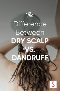 What Causes Dandruff, Best Shampoo For Dandruff, Dry Scalp Remedy, Severe Dandruff, Treat Dandruff, Dry Flaky Scalp, How To Treat Dandruff, Shampoo For Dry Scalp, Dandruff Remedy