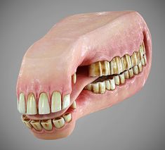 an image of a human mouth with teeth and gums on the upper half of it