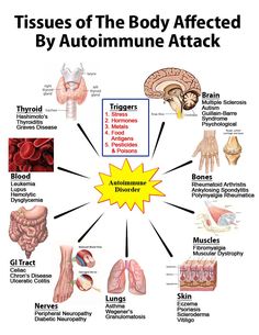 Many triggers can cause autoimmune disease and many body tissues can be affected. Autogenic Training, Guillain Barre, Body Tissues, Nutrition Education