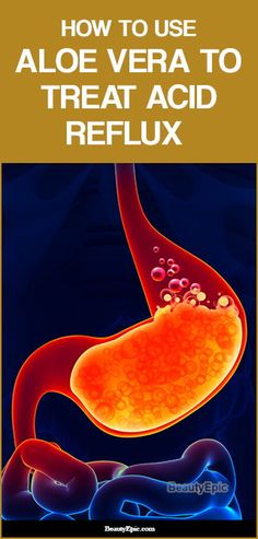 Acid Reflux Symptoms, Silent Reflux, Reflux Remedies, Stop Acid Reflux, Reflux Diet, Acid Reflux Diet, Reflux Symptoms, Acid Reflux