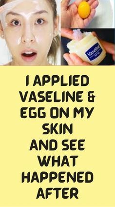 Vaseline Uses For Face, Vaseline For Face, Home Remedies For Wrinkles, Vaseline Uses, Vaseline Beauty Tips, Wrinkle Remedies