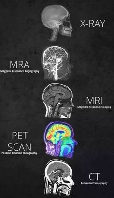 the brain is shown with different types of mris in each section, and there are many