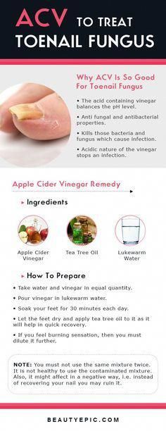 Apple Cider Vinegar Acne, Do It Yourself Nails, Apple Cider Vinegar Remedies, Apple Cider Vinegar For Skin, Apple Cider Vinegar Drink