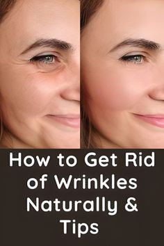 HOW TO GET RID OF WRINKLE NATURALLY & TIPS Rid Wrinkles, Homemade Face Wash, Skin Specialist