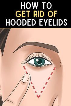 How To Remove Dark Marks From Feet Hooded Eyelids, Multani Mitti, Dark Mark, Black Spot, Home Remedies, Health And Wellness, Health And Beauty