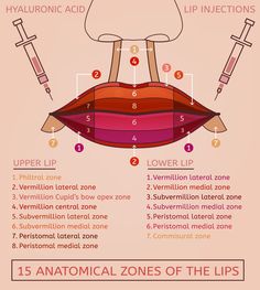 Dermal Fillers Lips, Derma Fillers, Medical Esthetician, Permanente Make-up