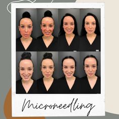 an image of a woman's face with six different facial expressions and the words microneeling on it