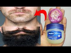 How to grow beard faster naturally at home with onion and vaseline | Beard growth oil - YouTube How To Beard Growth, How To Grow Facial Hair Men, How To Grow A Beard Tips, Patchy Beard Growth Tips, Growing Beard Tips Men, Mustache Growth Tips, Beard Growth Tips For Black Men, Beard Growth Tips How To Grow