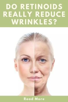 DO RETINOIDS REALLY REDUCE WRINKLES FAST Skincare Routine Tips, Anti Aging Skincare Routine, Skin Care Ideas, Eliminate Wrinkles, Routine Tips, Large Pores