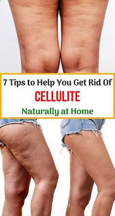 7 Tips to Help You Get Rid Of Cellulite Naturally at Home Woman Health, Hospital Health, Baking Soda Cleaning, Medical Hospital, Dark Underarms, Estrogen Dominance, Women Health Care, Healthy Advice, School Communication