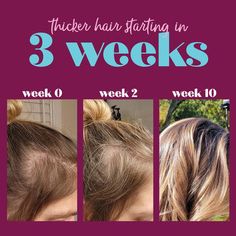 O Week, Thicker Hair, Hair Starting, Real People, Thick Hair Styles, 5 Star, Hair Styles, Hair