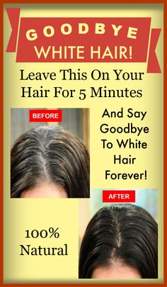 GOODBYE WHITE HAIR! Leave This On Your Hair For 5 Minutes And Say Goodbye To White Hair Forever! #hair #haircare #diyhair #whitehair #haircareremedies #diyremedies #blackhair Grey Hair Problem, Grey Hair Home Remedies, Stop Grey Hair, Hair Home Remedies, Grey Hair Remedies, Hair Paste, Hair Problem, Grey Hair Dye, Hair Care Remedies