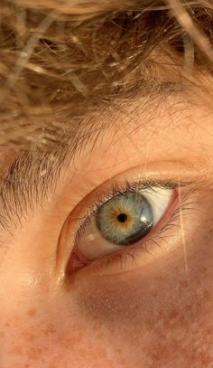 the eye of a person with freckled hair