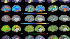 the different areas of the human brain are shown in this image, and there is no image