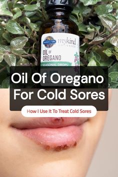 Save this pin to learn how I use oil of oregano for cold sores. If you’re looking for a natural cold sore remedy that packs a punch, this might become one of your favorites, too. Heal Cold Sores Fast, Cold Sore Essential Oil, Top Essential Oils, Essential Oils For Colds, Cold Sores