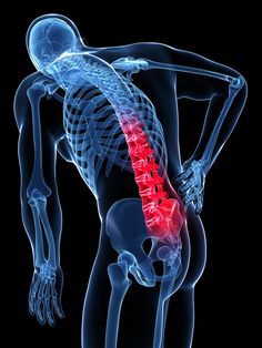 Confusion About Spinal Fusion - http://www.orthospinenews.com/confusion-about-spinal-fusion/ Lower Back Pain Causes, Forward Head Posture Exercises, Pregnancy Back Pain, Mid Back Pain, Spinal Fusion, Causes Of Back Pain, Middle Back Pain, Pinched Nerve, Back Pain Remedies