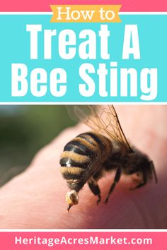 how to treat a bee sting on someone's hand with text overlay that reads, how to treat a bee sting