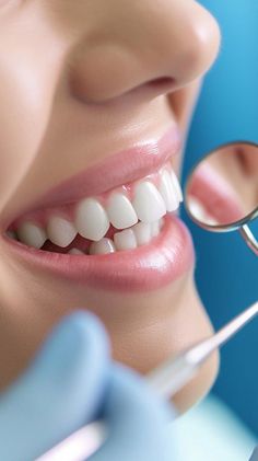 Download 'Dental Checkup Smile' - A patient smiles while undergoing a dentist's examination with a dental mirror and probe. - Get this free stock photo and more high-quality images on StockCake. No attribution required. Dentist Pictures, Dental Mirror, Dental Pictures, Dental Wallpaper, Dental Smile, Fix Teeth, Dental Photos, Dental Images, Dental Bonding