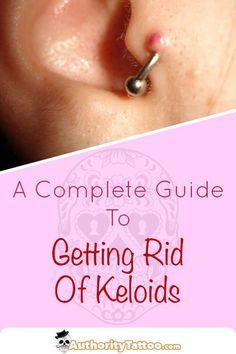 a close up of a person's ear with the words, a complete guide to getting rid of keloids