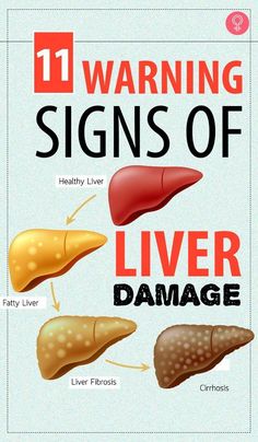 liver fatty natural treatments, liver symptoms disorders, liver detox cleanse remedies, liver detox cleanse from alcohol, liver detox cleanse symptoms, liver fatty natural treatments, liver fatty diet plan, liver fatty foods Signs Of Liver Damage, Liver Damage, Health Signs, Liver Detoxification, The Liver