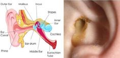 These are the top 7 remedies against ear infection: 1. Olive Oil Put some warm olive oil in the infected ear. After the wax becomes soft, remove it from the painful ear. 2. Garlic... Earache Remedies, Middle Ear, Ear Infections, Inner Ear, High Fever, Sinus Infection, Homemade Remedies, Back To Nature, Natural Medicine