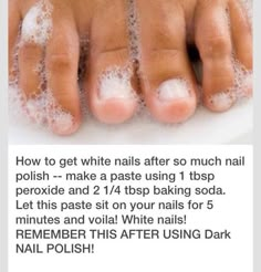 Stained Nails, Skin Care Routine For 20s, Catholic Education, Pinterest Nails, Age Gracefully, Pinterest Diy, Shellac Nails, Beauty Remedies, Foot Care