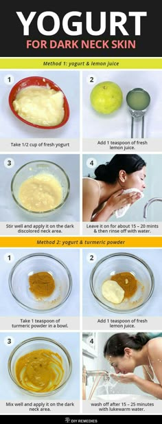 Remedy For Dark Neck, Neck Acne, Dark Neck, Clear Healthy Skin, Natural Skin Care Remedies, Good Skin Tips, Beauty Tips For Glowing Skin, Perfect Skin Care Routine