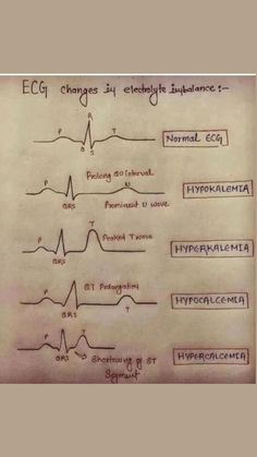 Electrolyte Imbalance, Learn Biology, Medical Student Motivation, Nursing Student Tips