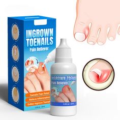 Improves Toenail Condition: Ingrown toenail oil softens embedded toenails, prevents ingrown toenails, corrects the angle of nail growth. Easy To Use At Home: Simply brush toenail drops to the affected toe with an twice per until the nail can be lifted out of the groove and easily trimmed. The drops soften and relieve the nail for easier removal at home. Suitable for All Ages:usually showing improvement after a period of of use. If daily used continuously, the toenail's condition will be improved Ingrown Toenail, Damaged Nails, Nail Repair, Edgy Nails, Ingrown Toe Nail, Nail Growth, Herbal Extracts, Feet Nails, Toe Nails