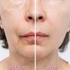 Nose Wrinkles, Wrinkle Patches, Chest Wrinkles, Erase Wrinkles, Natural Face Skin Care, Neck Wrinkles, Forehead Wrinkles, Face Makeup Tips, Skin Care Wrinkles