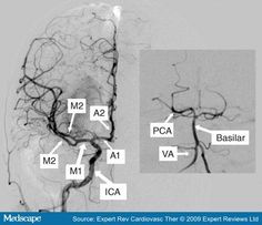 an mri scan shows the location of the brain and its major functions in which it is located