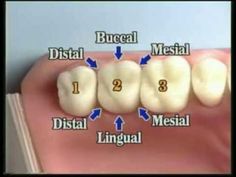 Dental Assistant Study Guide, Dental Charting, Dental Terminology, Hygiene School, Dentist Assistant, Dental Hygiene Gifts