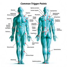 Myofascial release is a type of physical therapy often used to treat myofascial pain syndrome, a chronic pain disorder. Cupping Points, Full Body Massage Techniques, Trigger Point Release, Myofascial Pain Syndrome, Referred Pain, Body Massage Techniques, Massage Therapy Techniques, Trigger Point Therapy