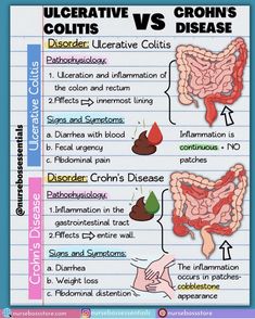 an image of the different types of stomachs and their functions in human health care