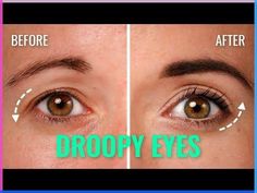 The easiest way to lift a droopy eye would be to apply a cat eye flick with an eyeliner, which also is exactly the thing we’d normally suggest. But if you al... Eyeliner To Lift Eyes, Bulging Eyes Makeup, Droopy Eyelids Makeup, Eye Lid Lift Droopy Eyelids, Eyeliner For Droopy Eyes, Eye Makeup For Droopy Eyes, Makeup For Droopy Eyelids, Droopy Eye Makeup, How To Use Eyeshadow