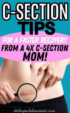 C-section recovery tips and c-section recovery essentials to help c-section moms recover fast, post c-section recovery must-haves, postpartum products for c-section moms, after birth essentials Best Postpartum Belly Wrap, Postpartum Products, Post C Section, Post Partum Belly Wrap, Postpartum Essentials, C Section Recovery, Body After Baby