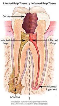 900+ ideias de O D O N T O em 2022 | odontologia, dentário, tudo sobre odontologia Tooth Pain Remedies, Teeth Problems, Autogenic Training, Dental Pictures, Tooth Ache Relief, Dental Images, Remedies For Tooth Ache, Dental Offices