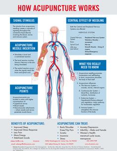 How Acupuncture Works — Acutonix Acupuncture Points Chart, Acupressure Therapy, Peripheral Nervous System, Eastern Medicine, Acupressure Massage, Organic Remedy, Acupuncture Points, Acupressure Points