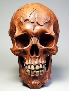 a human skull is shown with teeth missing