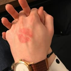 a person holding their hand up in the air with red spots on his face and wrist