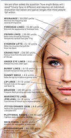 Botox Units, Facial Swelling, Aesthetic Nursing, Under Eye Lines, Cosmetic Nurse, Facial Injections, Botox Facial, Derma Fillers