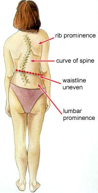 Straight Spine, Middle Back Pain, Forward Head Posture, Digestion Problems