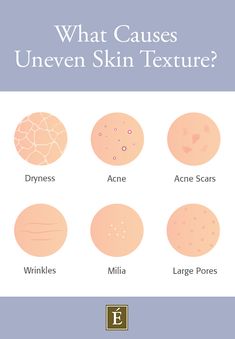 We’re all after #skin with a smooth surface, but the reality is that most of us experience uneven skin texture ���😤 Learn more about what causes textured skin and how to improve it. ---- #skintexture #skincare #skincaretips How To Smooth Textured Skin, Uneven Skin Texture Skincare, Uneven Texture Skin, Smooth Skin Quotes, How To Smooth Skin, How To Improve Skin Texture, Textured Skin Routine, Skincare For Textured Skin, How To Get Smooth Skin