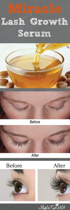 Grow Eyelashes, Health Coconut Oil, Lash Growth Serum, How To Grow Eyelashes, Lash Growth, Coconut Oil Uses, Hair Growth Serum, Eyelash Growth, Beauty Remedies