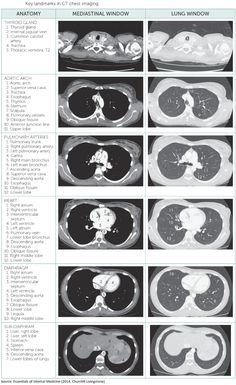 an mri scan shows the different areas of the brain and their functions in which they are located