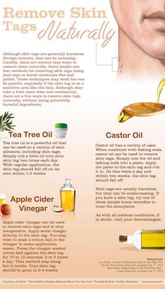 #NaturalSleepRemedies Remove Skin Tags, Remove Skin Tags Naturally, Skin Moles, Home Remedy For Cough, Skin Tags, Skin Natural Remedies