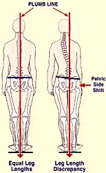 Hip Problems, Tight Hip Flexors, Muscle Imbalance, Psoas Muscle, Tight Hips, Hip Flexor, Massage Therapist