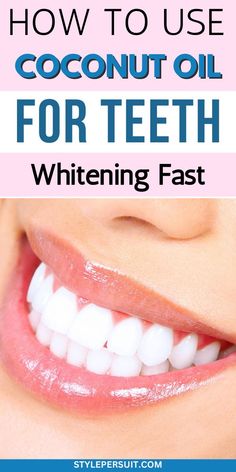 Dentistry Motivation, Teeth Tips, Natural Teeth Whitening Diy, Teeth Whitening Homemade, Nose Picking, Coconut Oil For Teeth, Discolored Teeth, Teeth Whitening Remedies, Teeth Whitening Diy