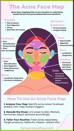 The Acne Face Map, Acne Face Mapping, What Your Breakouts Mean, Acne Solutions building routine quickly in my blog Face Map Acne, Acne Face Mapping, Acne Chart, Acne Face Map, Face Map, Face Mapping Acne, Forehead Acne, Face Mapping, Acne Face