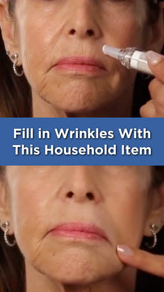 This at home remedy for aging wrinkles doesn't require cream. Christmas Makeup Looks, Wrinkles Remedies Face, Makeup Looks To Try, Wrinkle Remedies, Natural Face Skin Care, Lip Wrinkles, Face Makeup Tips, Skin Care Wrinkles, Grooming Tips